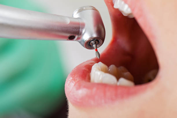 Best Emergency Dental Care for Sports Injuries in Tomahawk, WI